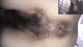 Asshole View 15
