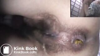 Asshole View 15