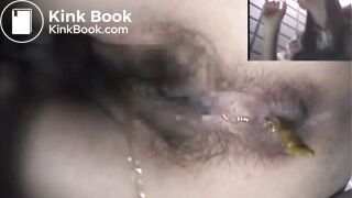 Asshole View 15