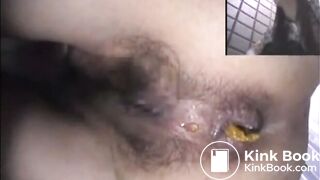 Asshole View 15