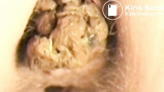 Constipated Shit Compilation