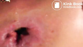 Anal Fucking In Ass That Needs To Shit Badly