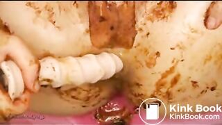 Japanese Prolapse Scat