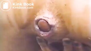 shit vagina