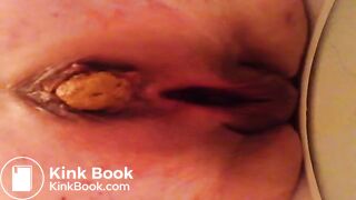 Taking a shit at work