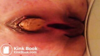 Taking a shit at work