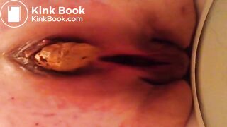 Taking a shit at work