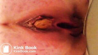 Taking a shit at work