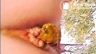 Girl shitting outdoor closeup