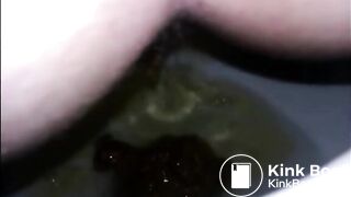 Girl shitting diarrhea in the toilet closeup