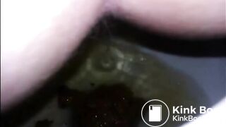 Girl shitting diarrhea in the toilet closeup