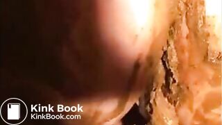 Woman shit diarrhea and smear it on her butt