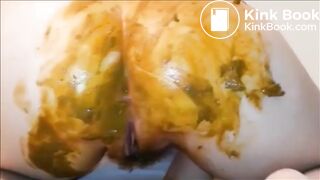 Hairy milf shitting and fingering her asshole