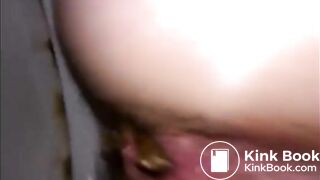 Hairy woman shitting a lot of diarrhea closeup