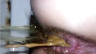 Hairy woman shitting a lot of diarrhea closeup