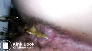 Hairy woman shitting a lot of diarrhea closeup