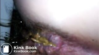 Hairy woman shitting a lot of diarrhea closeup
