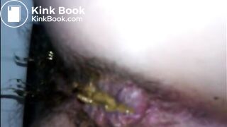Hairy woman shitting a lot of diarrhea closeup