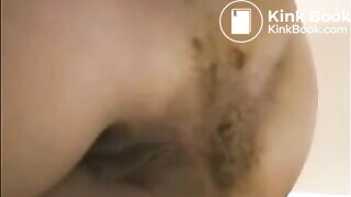 Milf is showing her pulsating asshole with shit