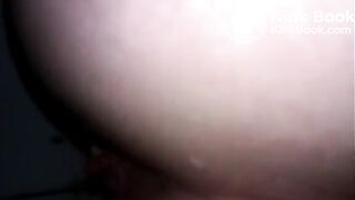 Hairy woman shitting very closeup