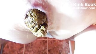Hard push of huge turd seen close up