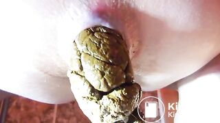 Hard push of huge turd seen close up