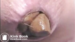 Girl shitting a very big turd closeup