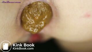 The closest of closeup poops