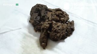 a beautiful scatting asshole