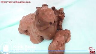 Two struggle to poop constipated