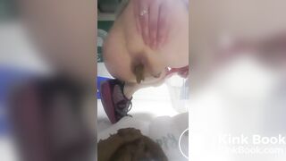 suppositories not needed