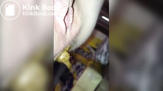 hairy asshole shit