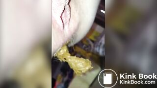 hairy asshole shit