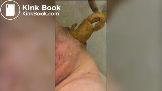 Shitting with prolapse - ThisVidcom