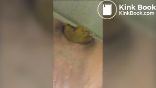 Shitting with prolapse - ThisVidcom