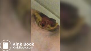 Shitting with prolapse - ThisVidcom