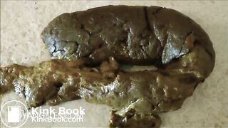 Easy release of a big soft poop