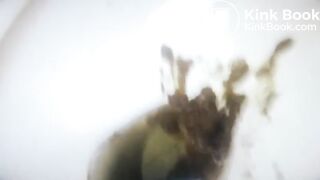 HDL - Airport Public Tiolet Diarrhea