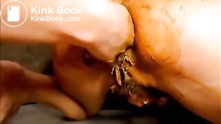 Lesbian milf fisting her lover asshole while shitting