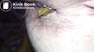 Hairy asshole mature woman shitting closeup
