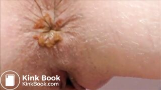 Woman shitting a lot of diarrhea closeup in hd and we can see her pulsating asshole