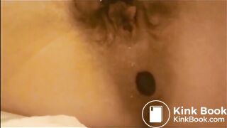 Hairy cunt milf shitting a load of diarrhea