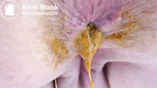 K - Breathtaking Kackoptik - ThisVidcom