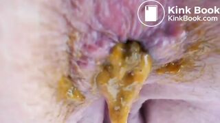 K - Breathtaking Kackoptik - ThisVidcom