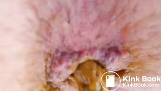 K - Breathtaking Kackoptik - ThisVidcom