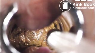 inside asshole while pooping n farting