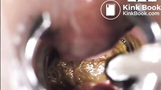 inside asshole while pooping n farting