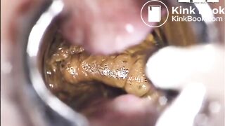 inside asshole while pooping n farting