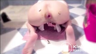 Anal insertion in prolapsed anus and shit