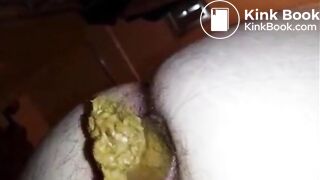 Hairy butt woman shitting a big quantity closeup